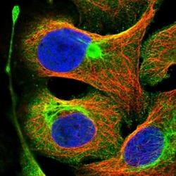 FLJ21908 Antibody, Novus Biologicals:Antibodies:Primary Antibodies