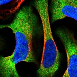 FLJ21908 Antibody, Novus Biologicals 0.1mL; Unlabeled:Antibodies, Polyclonal