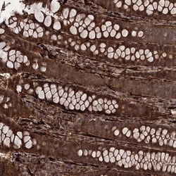 FLJ21908 Antibody, Novus Biologicals:Antibodies:Primary Antibodies