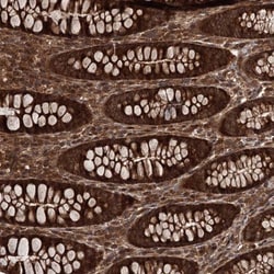 FLJ21908 Antibody, Novus Biologicals 0.1mL; Unlabeled:Antibodies, Polyclonal