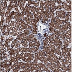 FLJ21963 Antibody, Novus Biologicals:Antibodies:Primary Antibodies