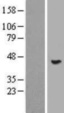 Novus Biologicals&trade;&nbsp;POMK/SGK196 Overexpression Lysate