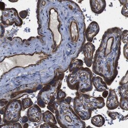POMK/SGK196 Antibody, Novus Biologicals 0.1mL; Unlabeled:Antibodies, Polyclonal
