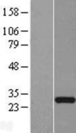 Novus Biologicals&trade;&nbsp;FLJ23584 Overexpression Lysate