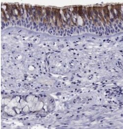 FLJ23834 Antibody, Novus Biologicals:Antibodies:Primary Antibodies
