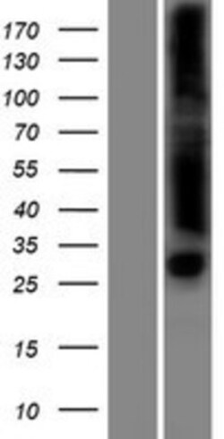 Novus Biologicals&trade;&nbsp;FLJ35220 Overexpression Lysate