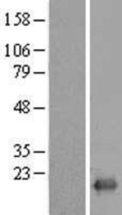Novus Biologicals&trade;&nbsp;FLJ37078 Overexpression Lysate