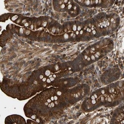 FLJ37078 Antibody, Novus Biologicals 25 &mu;L, Unconjugated:Antibodies,
