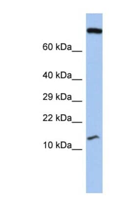 FLJ37543 Antibody, Novus Biologicals 100&mu;L; Unlabeled:Antibodies, Polyclonal