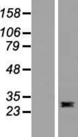 Novus Biologicals&trade;&nbsp;Flt-3 Ligand/FLT3L Overexpression Lysate