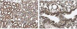 Flt-3/Flk-2/CD135 Antibody (12B6) - Azide and BSA Free, Novus Biologicals