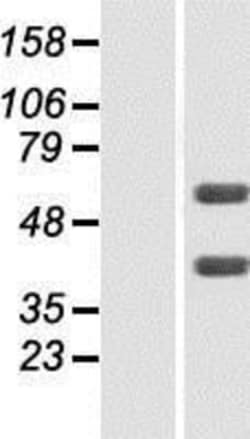 Novus Biologicals&trade;&nbsp;FLVCR2 Overexpression Lysate