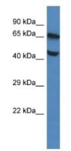 FLVCR Antibody, Novus Biologicals 100 &mu;L | Buy Online | Novus Biologicals | Fisher Scientific
