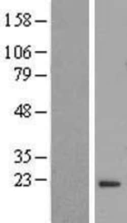 Novus Biologicals&trade;&nbsp;FLYWCH2 Overexpression Lysate