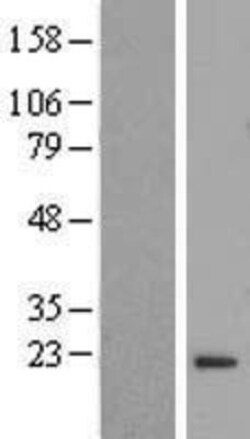 Novus Biologicals&trade;&nbsp;FLYWCH2 Overexpression Lysate