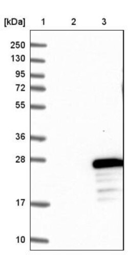 FLYWCH2 Antibody, Novus Biologicals 25 &mu;L | Buy Online | Novus Biologicals | Fisher Scientific
