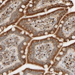 FMO1 Antibody, Novus Biologicals:Antibodies:Primary Antibodies