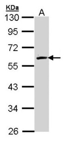 FMO2 Antibody, Novus Biologicals 0.1mg; Unlabeled:Antibodies, Polyclonal