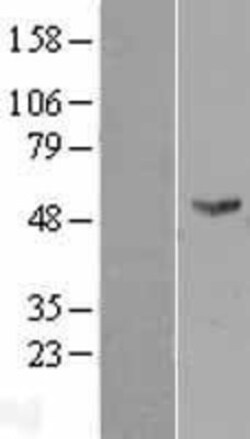 Novus Biologicals&trade;&nbsp;FMO2 Overexpression Lysate