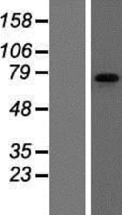 Novus Biologicals&trade;&nbsp;FMRP Overexpression Lysate