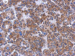 FN3K Antibody, Novus Biologicals 0.1mL; Unlabeled:Antibodies, Polyclonal