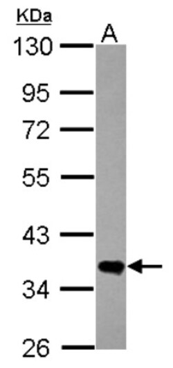FN3K Antibody, Novus Biologicals 0.1mL; Unlabeled:Antibodies, Polyclonal