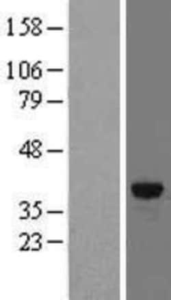 Novus Biologicals&trade;&nbsp;FN3K Overexpression Lysate