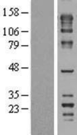 Novus Biologicals™ FNBP4 Overexpression Lysate