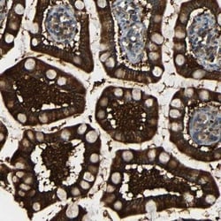 FNDC3A Antibody, Novus Biologicals 0.1mL; Unlabeled:Antibodies, Polyclonal