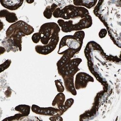 FNDC3A Antibody, Novus Biologicals 0.1mL; Unlabeled:Antibodies, Polyclonal