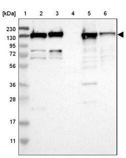 FNDC3A Antibody, Novus Biologicals 0.1mL; Unlabeled:Antibodies, Polyclonal