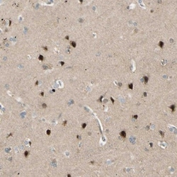 FNDC3B Antibody, Novus Biologicals 25 &mu;L | Buy Online | Novus Biologicals | Fisher Scientific