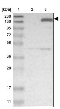 FNDC3B Antibody, Novus Biologicals 25 &mu;L | Buy Online | Novus Biologicals | Fisher Scientific