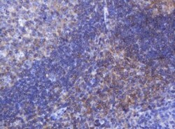 FNDC4 Antibody (OTI1B7), Novus Biologicals 0.1mL; Unlabeled:Antibodies,