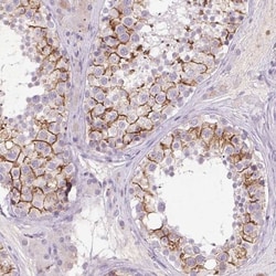 FNDC7 Antibody, Novus Biologicals 25 &mu;L, Unlabeled:Antibodies, Polyclonal