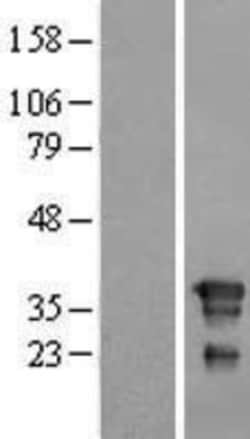 Novus Biologicals™ FNDC8 Overexpression Lysate
