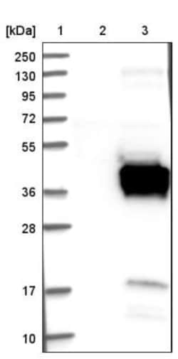 FNDC8 Antibody, Novus Biologicals 0.1mL; Unlabeled:Antibodies, Polyclonal