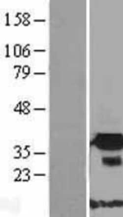 Novus Biologicals&trade;&nbsp;FNDC9 Overexpression Lysate