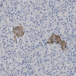DDO Antibody, Novus Biologicals:Antibodies:Primary Antibodies
