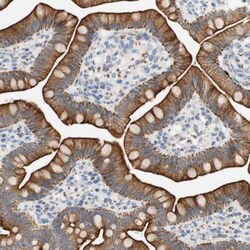 MCC Antibody, Novus Biologicals:Antibodies:Primary Antibodies
