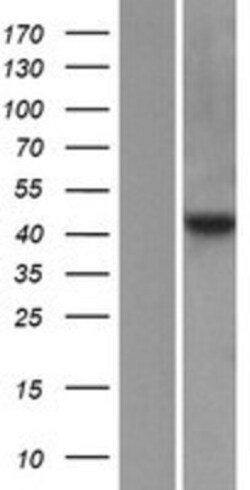 Novus Biologicals&trade;&nbsp;FNTA Overexpression Lysate