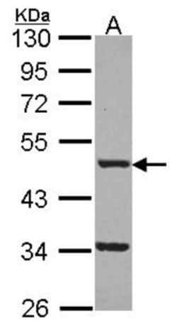 FNTB Antibody, Novus Biologicals 0.1mL; Unlabeled:Antibodies, Polyclonal
