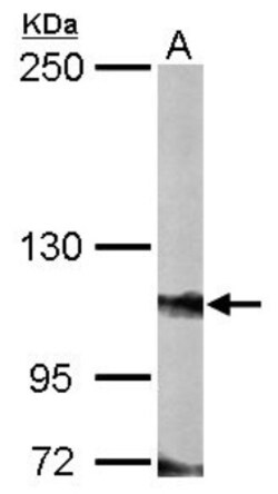 FOG2 Antibody, Novus Biologicals 0.1mL; Unlabeled:Antibodies, Polyclonal
