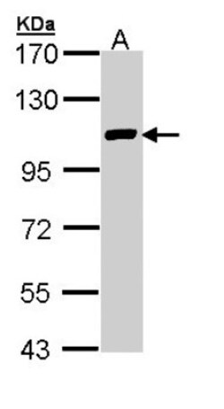 FOG2 Antibody, Novus Biologicals 0.1mL; Unlabeled:Antibodies, Polyclonal