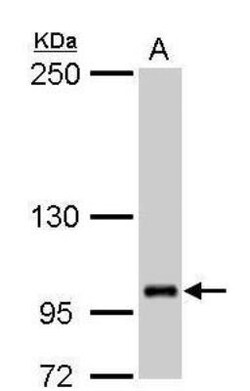 FOG2 Antibody, Novus Biologicals 0.1mL; Unlabeled:Antibodies, Polyclonal