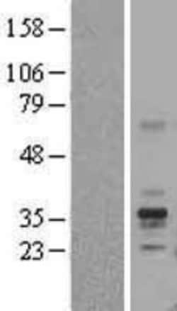 Novus Biologicals&trade;&nbsp;FOLR1 Overexpression Lysate