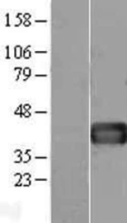 Novus Biologicals™ Follistatin Overexpression Lysate