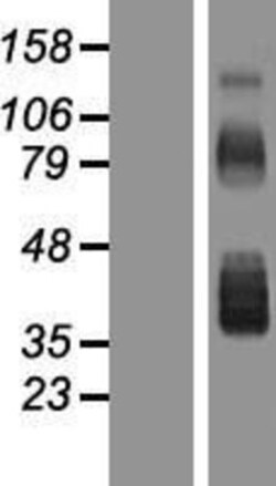 Novus Biologicals&trade;&nbsp;Follistatin Overexpression Lysate