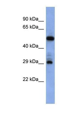 FOLR1 Antibody, Novus Biologicals 0.05mg; Unlabeled:Antibodies, Polyclonal