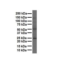 FOLR1 Antibody, Novus Biologicals 0.05mg; Unlabeled:Antibodies, Polyclonal